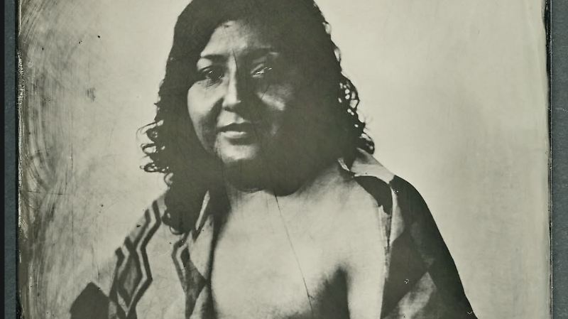Foto cáncer de mama